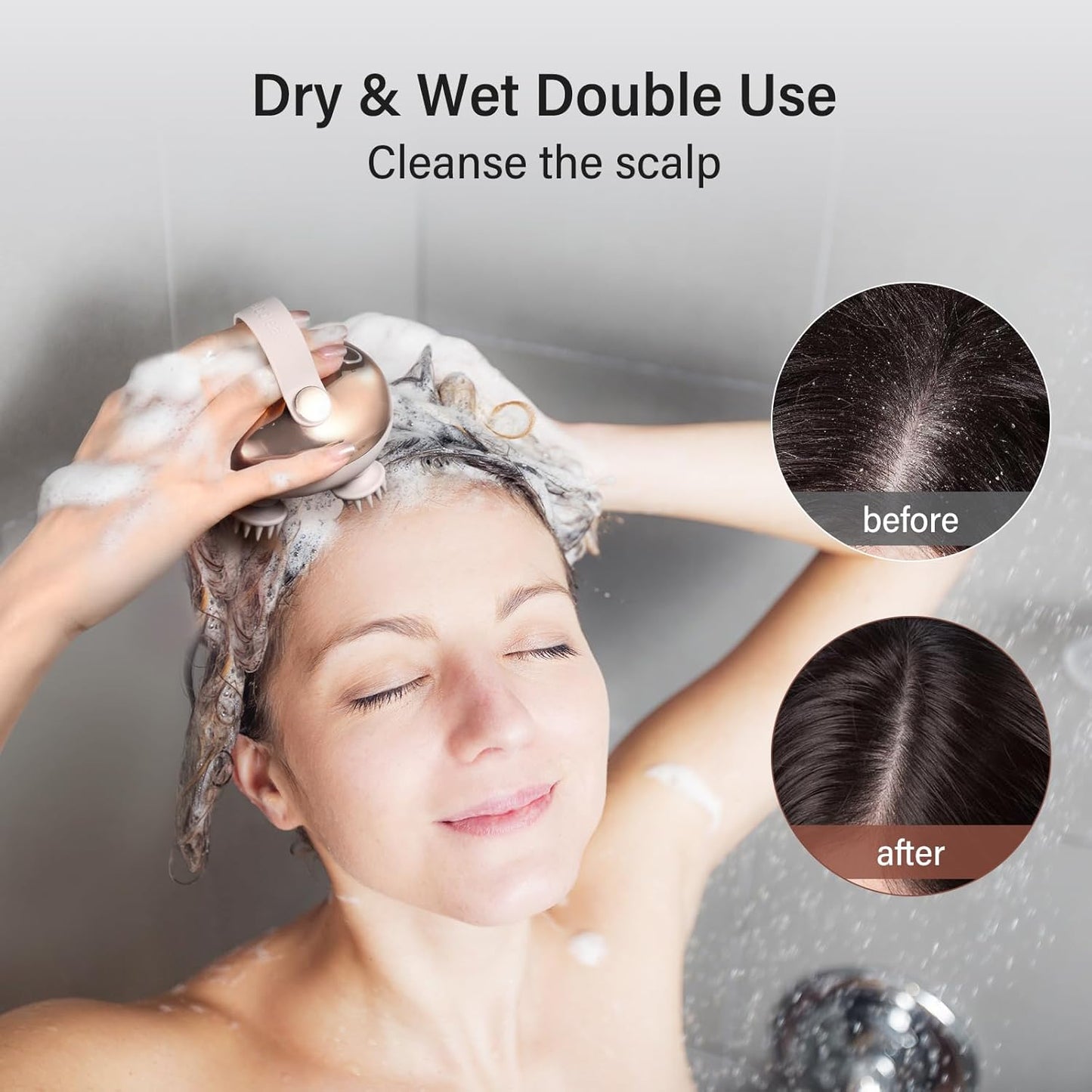 ### **Arboleaf Scalp Massager – 5 in 1 Rechargeable Waterproof Head Massager**
