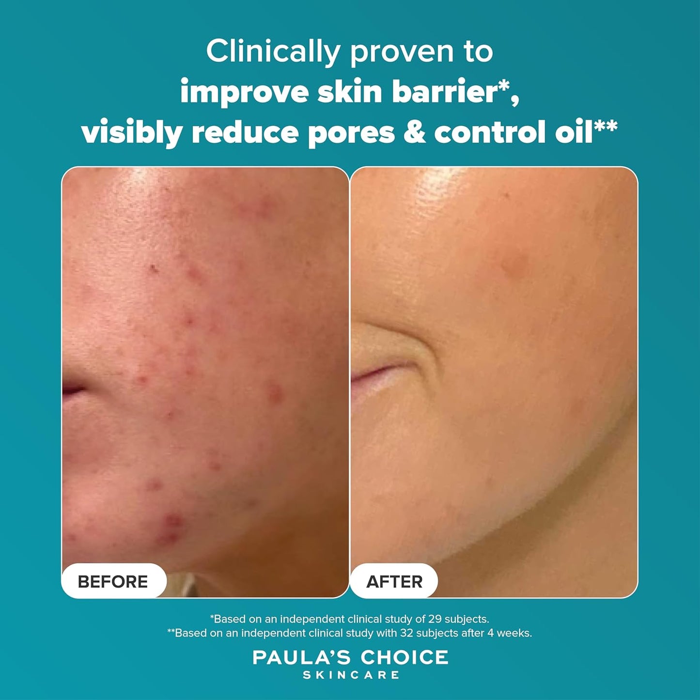 **Paula's Choice SKIN PERFECTING 2% BHA Liquid Exfoliant**